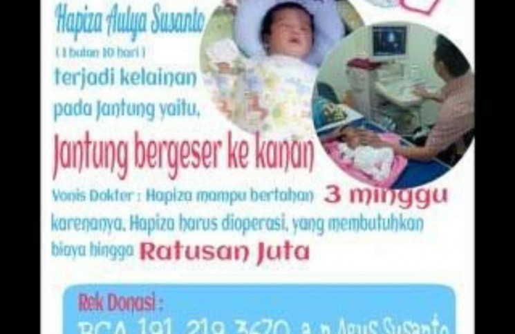 Jantung geser ke Kanan, bayi Hapiza butuh bantuan