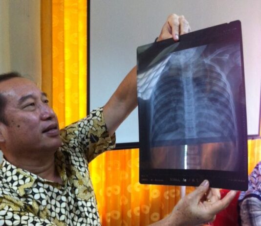 Sibka Fiaini meninggal bukan karena tifus, RSUD Bantah lalai lakukan perawatan