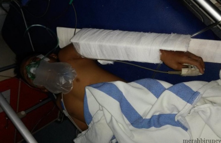 Ngebut berakhir maut, satu meninggal, satunya koma di RS